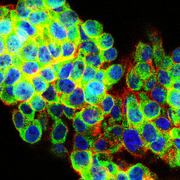 PRKCD Antibody