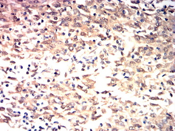 PRKCD Antibody