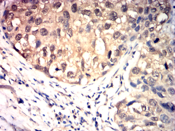 PRKCD Antibody