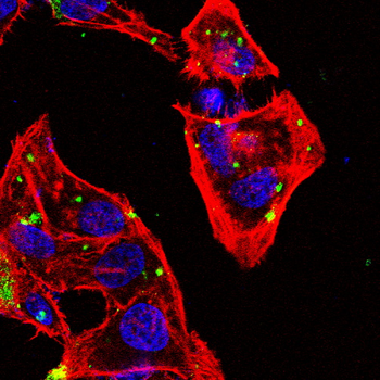 HEXB Antibody