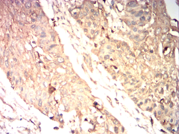 HEXB Antibody