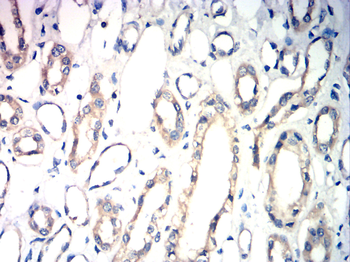 HEXB Antibody