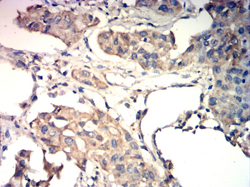 HEXB Antibody
