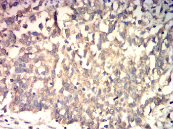 HEXB Antibody