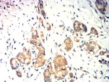 HEXB Antibody