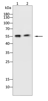 HEXB Antibody