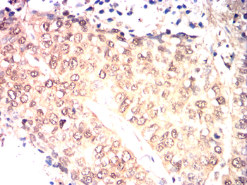 CYP2R1 Antibody