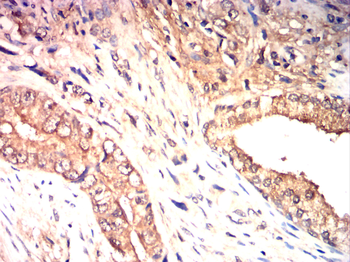 CYP2R1 Antibody