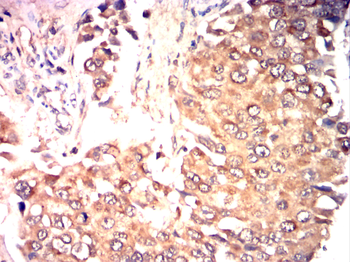 CYP2R1 Antibody