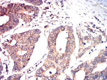 CYP2R1 Antibody
