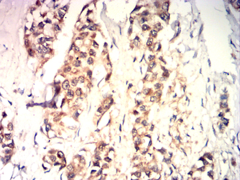 CDK1 Antibody