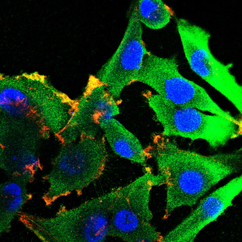 FABP4 Antibody