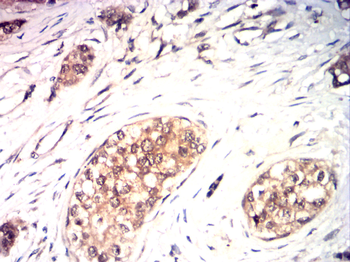 FABP4 Antibody