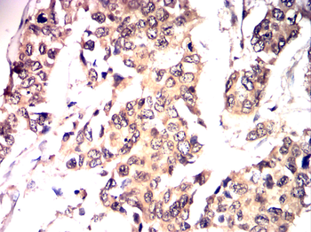 FABP4 Antibody
