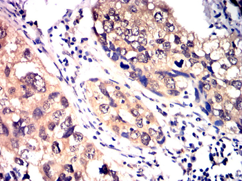 FABP4 Antibody
