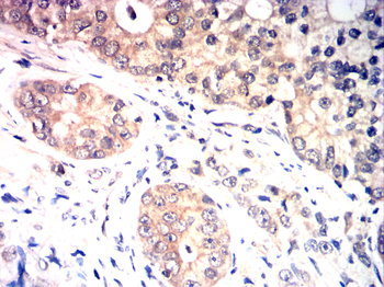 FABP4 Antibody