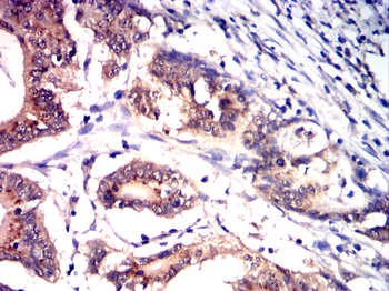FABP4 Antibody