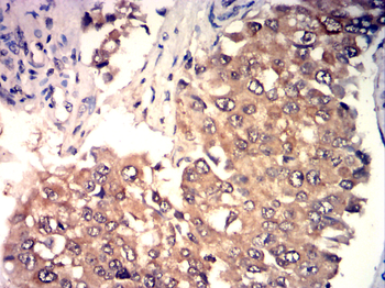 FABP4 Antibody