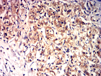 FABP4 Antibody