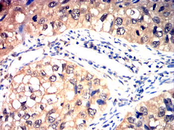 MTOR Antibody