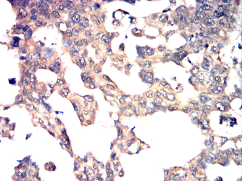 MTOR Antibody