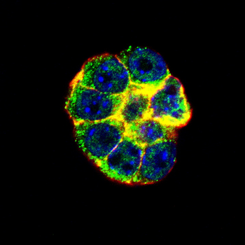 CEBPB Antibody