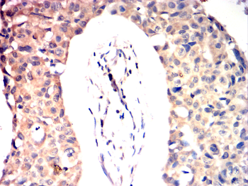 CEBPB Antibody