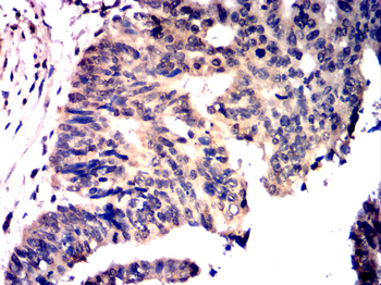CEBPB Antibody