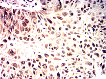 CEBPB Antibody