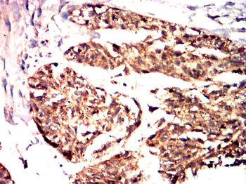 CEBPB Antibody