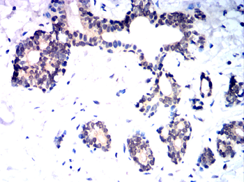 RTN4 Antibody