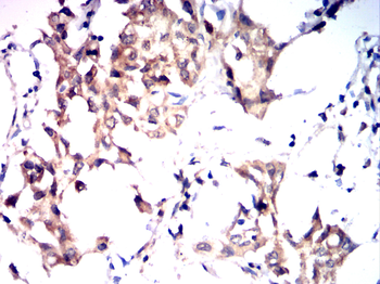 RTN4 Antibody