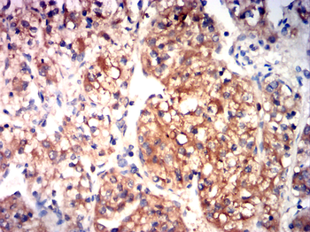 RTN4 Antibody