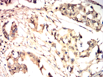 DCX Antibody