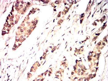 DCX Antibody