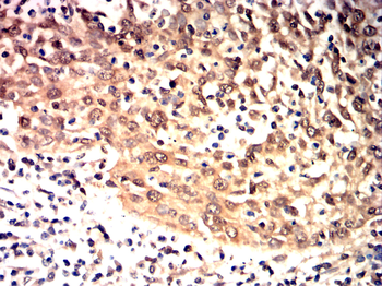 DCX Antibody
