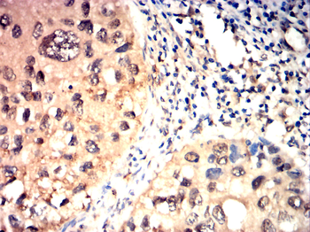 DCX Antibody
