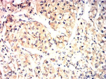 DCX Antibody