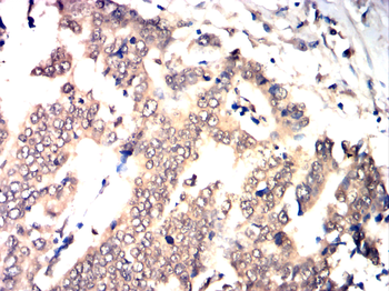 DCX Antibody