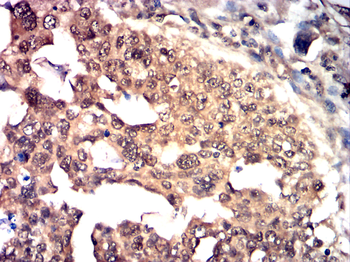 CYP1B1 Antibody