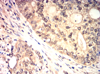 ATF3 Antibody