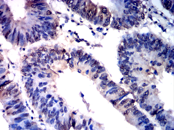 ATF3 Antibody