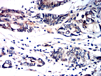 ATF3 Antibody