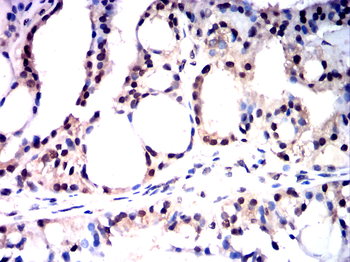 ATF3 Antibody