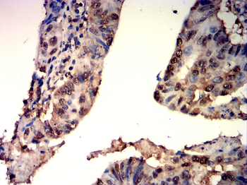 ATF3 Antibody