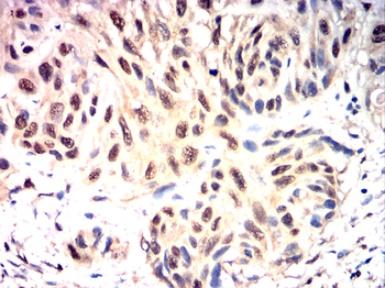 ATF3 Antibody