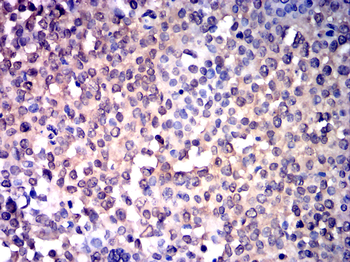 ATF3 Antibody