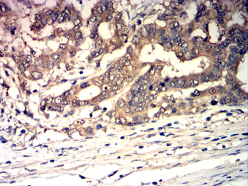 TRIM21 Antibody