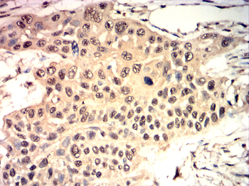 TRIM21 Antibody