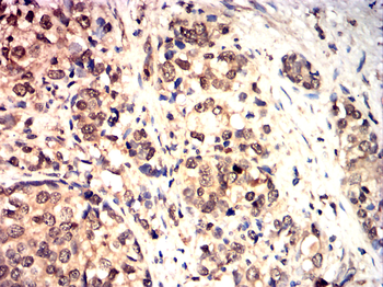 TRIM21 Antibody